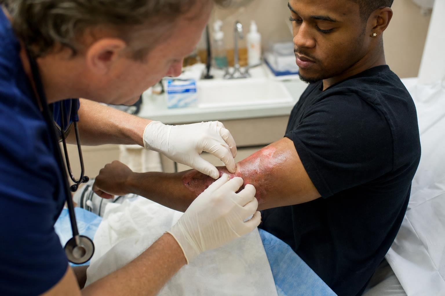 doctor assessing burn injury severity in Atlanta emergency room